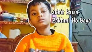 DAY 65 | Sab Kuch Normal Tha… Phir Ye Ho Gaya Ayush Ke Saath 🤕