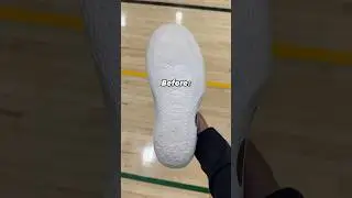 They Used HIS FACE As The Traction?! 🦶
