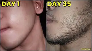 5 Week Beard Growth Using Minoxidil 🇵🇭 | Real Pinoy Result (Day 1 to 35 Transformation)