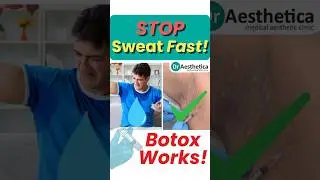 Stop Excessive Underarm Sweating | Botox Treatment That Actually Works!