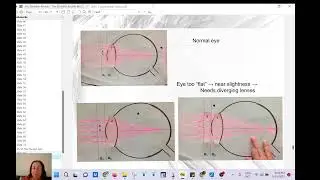 geometrical optics V - problem MCAT (human eye)  #optics