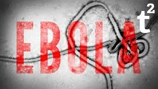 13 Surprising Facts About: Ebola