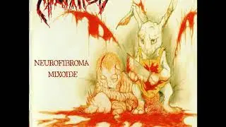 MIXOMATOSIS (Neurofibroma mixoide full album)