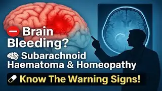Subarachnoid Haematoma | दिमाग में खून का जमाव | Brain Bleeding & Homeopathic Treatment