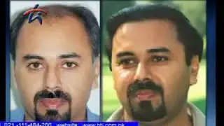 Dr. Humayun's - Hair Transplant Institute - Full Documentary - 1/2