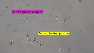 Germ tube test negative and positive Candida species demonstration