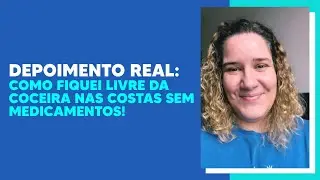 Depoimento Real:  Fiquei Livre da Coceira Nas Costas Notalgia Parest&eacute;sica com Fisioterapia!