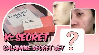 K-Secret Calamine Secret Set (Pink Solution) | Little Miss Potchi