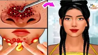 Treatment more Mouth [ASMR animation] Removing cockroach from disclosure under any |2d animation