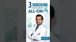 All-On-4 Dental Implants | Surprising Facts You Need to Know!