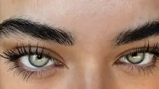 𓆩💉𓆪 Göz rengin nasıl bu kadar açık | Melanin yok edici ☆࿐࿔