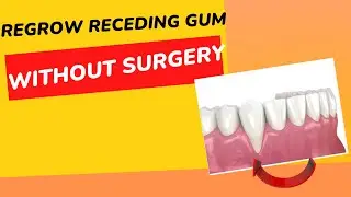 Revolutionary New Supplement Can Reverse Receding Gums Without Surgery [See the Amazing Results]