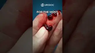 Do NOT use Vacuum Erection Devices until you've watched THIS!
