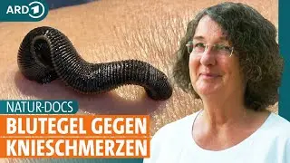 Knieschmerzen: So helfen Physiotherapie, Fasten, Schröpfen und Blutegel bei Arthrose | ARD GESUND
