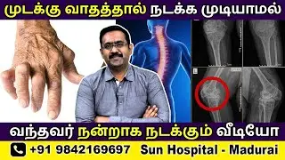 முடக்கு வாதம் | Rheumatoid Arthritis காரணமாக நடக்க முடியலையா?  Exercises in Tamil | Sun Hospital