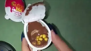 The Most Satisfying Crazy Egg Sounds|ASMR