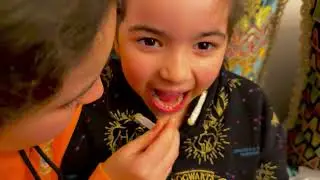 I pulled out my sister Haya&rsquo;s  first baby tooth.