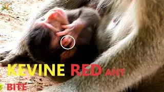 PAINFUL OF NEWBORN KEVIN ESCAPE ANY MORE SEEN RED ANT BITE NOT REMOVE |