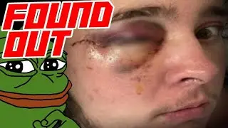 ICE Rioter Claims He's Blind in One Eye After Federal Officer Shot Him