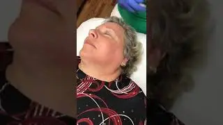 Dermaplaning LIVE  at The Centre PC