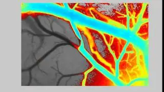 Brain Blood Flow and Clot Formation
