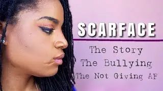 STORY TIME: THEY CALL ME SCARFACE...AND IDGAF | How To Love Yourself With Imperfections