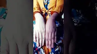 Fair lovely cream k result