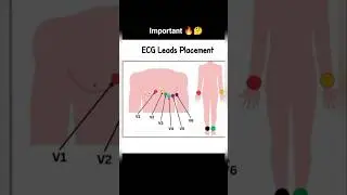 ECG leads placement 📚✅#ecg #leads #placement