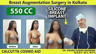 Breast Augmentation Surgery in Kolkata | 550cc Before After Results by Dr Nagwani | Watch Now