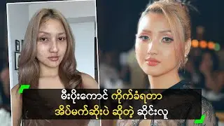 မီးပိုးကောင် ကိုက်ခံရတာ အိပ်မက်ဆိုးပဲ ဆိုတဲ့ ဆိုင်းလူ