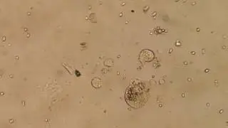 Dying protozoon