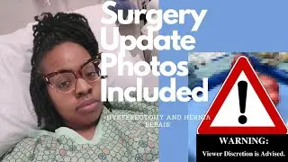 Life Update| Partial Hysterectomy, Hernia Repair, and Moving mid-Recovery