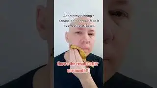 Botox using a banana peel! #shorts #funny #comedy #comedyvideos #botox #plasticsurgery #memes