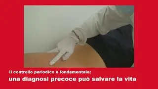 Come si fa a riconoscere un neo sospetto: cosa e dove contrallare