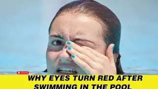 Why Eyes Turn Red After Swimming In The Pool