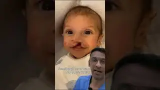 Cleft lip repair is an operation to reconstruct the shape of the lip and nose.