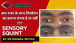 Squint surgery in indore | Best squint treatment in indore