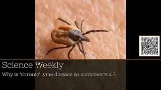 The Lyme Disease Debate: Unraveling Chronic Suffering with Patrick Barkham #podcast #20Minutes