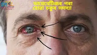 Dr R K Singh MBBS, PGDD (Diabetologist)