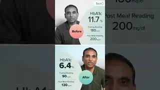 Diabetes Care Program Review - BeatO Unbeatable Ep. 1 #diabetes #diabetescare #diabetesmanagement