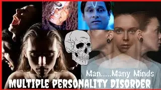 Multiple personality Disorder | Tamil | Mr VLOGGER TAMIL | Disociative identify disorder | VIDEO 87