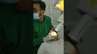 IOPAR 26 #MOLAR X RAY