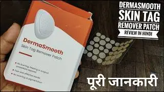Dermasmooth Skin Tag Remover Patch | derma smooth skin tag removal | Flipkart Big Billion Day Sale
