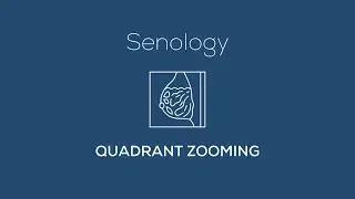 Senology - Quadrant Zooming