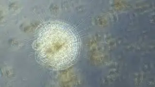 Heliozoa