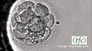 Human Embryo Growing from Fertilization to Day 6 Blastocyst