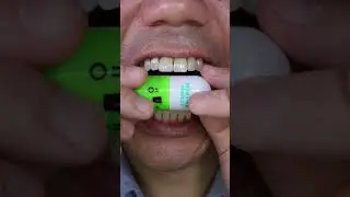 ASMR 