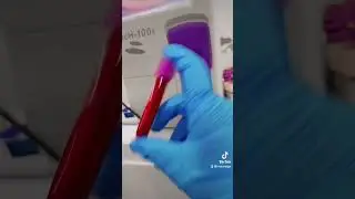 Let's do complete blood count #blood #cbc #hematologyanalyzer #EDTA