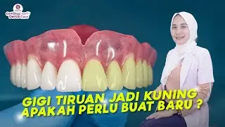 GIGI PALSU BERUBAH JADI KUNING PERLU DIGANTI ? GIGI PALSU BISA BIKIN BAU ?