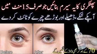 Alum Magic Remove Wrinkles, Shrink Open pores | Phitkiri K Feyde |Alum Benifits🥹DIY Anti Aging Serum